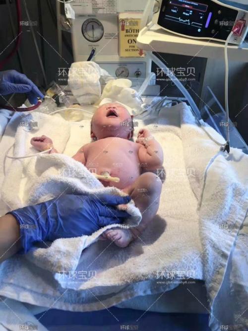 出生在加拿大福利待遇怎么样 出生在加拿大福利待遇怎么样